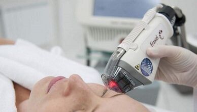 Πώς γίνεται η κλασματική ανανέωση του δέρματος;